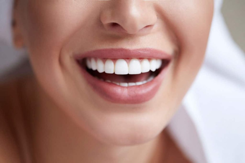 How Much Does Teeth Whitening Cost in Albuquerque?